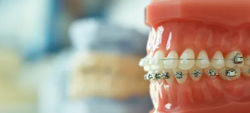 best orthodontist san antonio tx