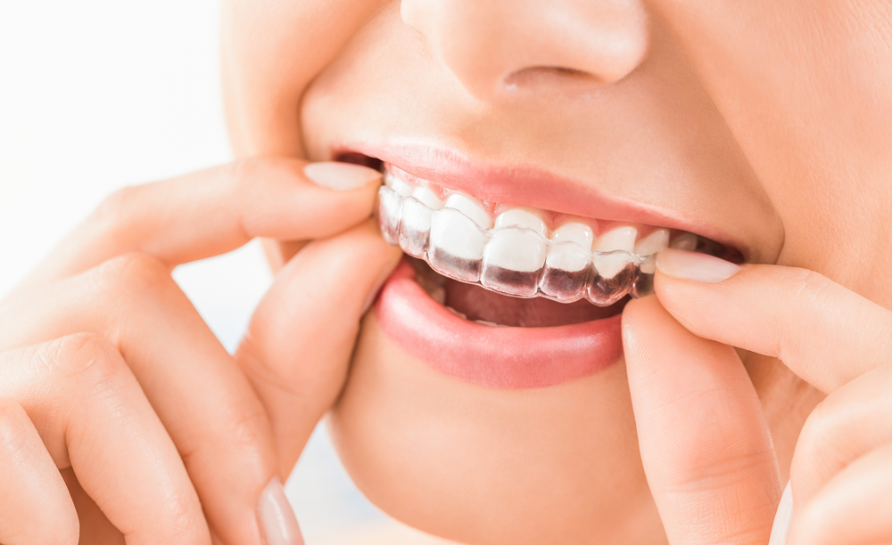 dentist braces near me