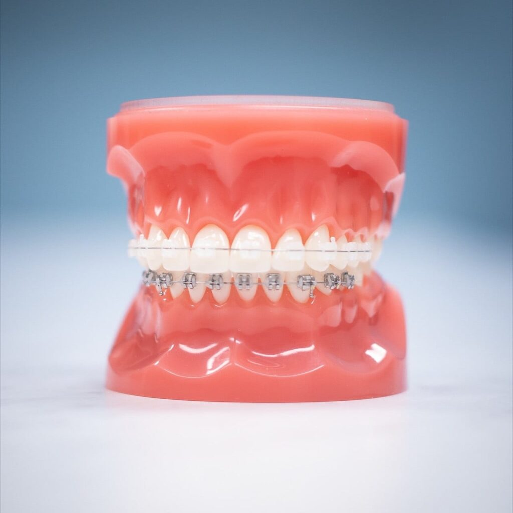 adult braces san antonio