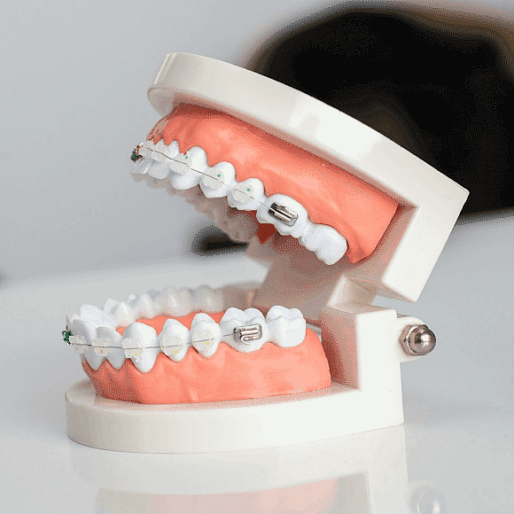 cost of braces san antonio