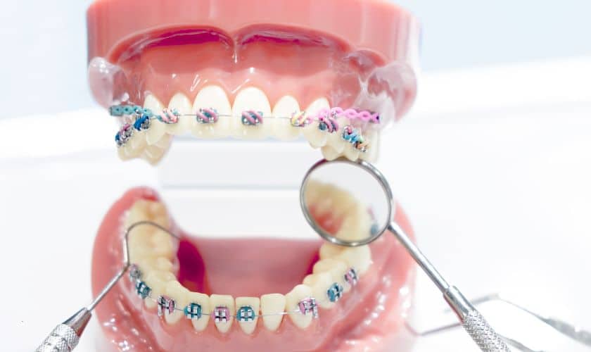 Orthodontist in Spring